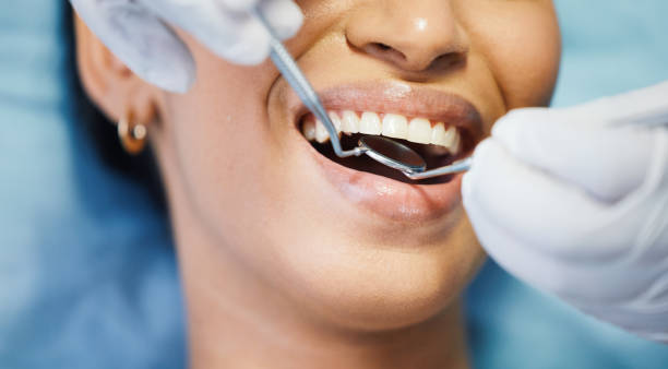 Best Emergency Cosmetic Dentistry (e.g., broken veneers) in Sammamish, WA